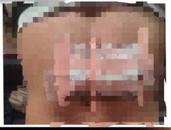 Buruh Alami Luka Robek Akibat Serangan Golok Dugaan Penganiayaan Polsek Cigudeg Lakukan Investigasi Penyelidikan Lebih Lanjut