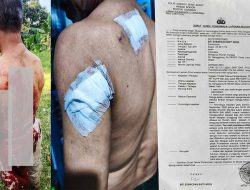 Penganiayaan Berat di Caringin Bogor: Wilson Lalengke Kecam Aksi Main Hakim Sendiri, Desak Polisi Usut Tuntas Terduga Pelaku ‘Imron’